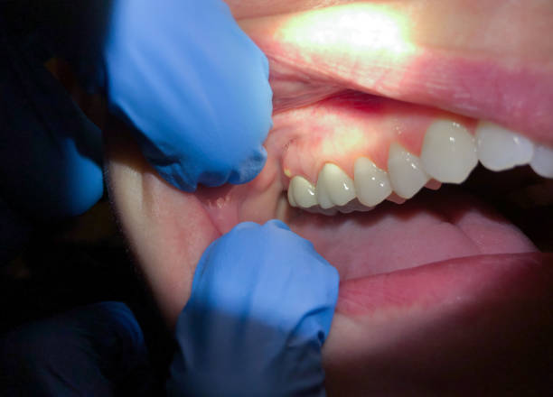 Best Emergency Dental Services for Seniors in Niagara University, NY